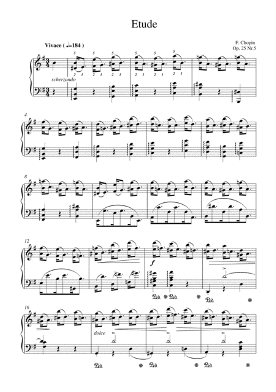 Chopin - Etude Op. 25, No. 5 in E minor for piano solo Piano Method scores gallery preview page 2