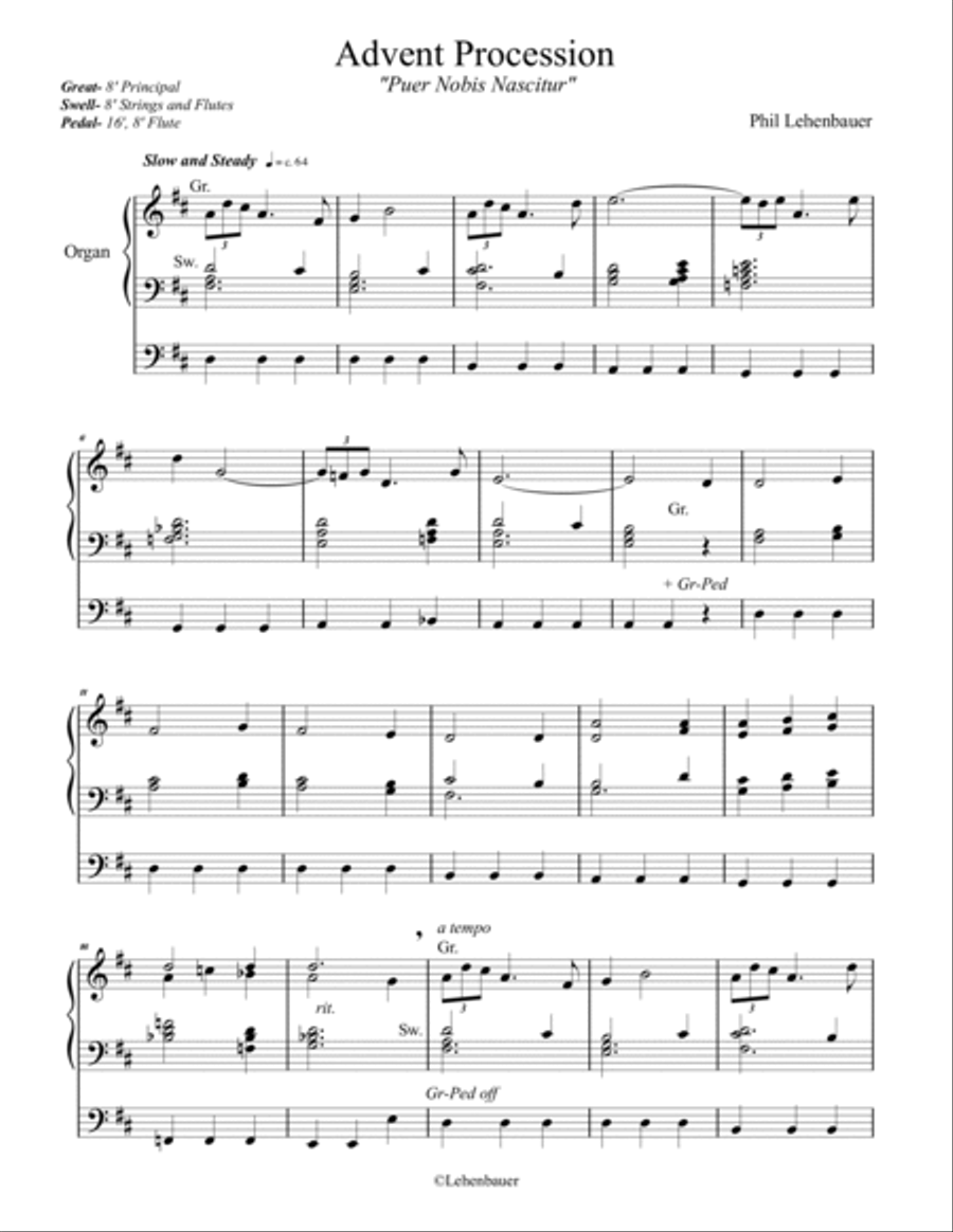 Advent and Christmas Organ Works, Vol.2 by Phil Lehenbauer Organ Solo scores gallery preview page 6