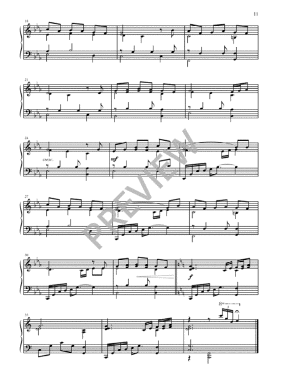 Six Advent Christmas Carols Christmas scores gallery preview page 13