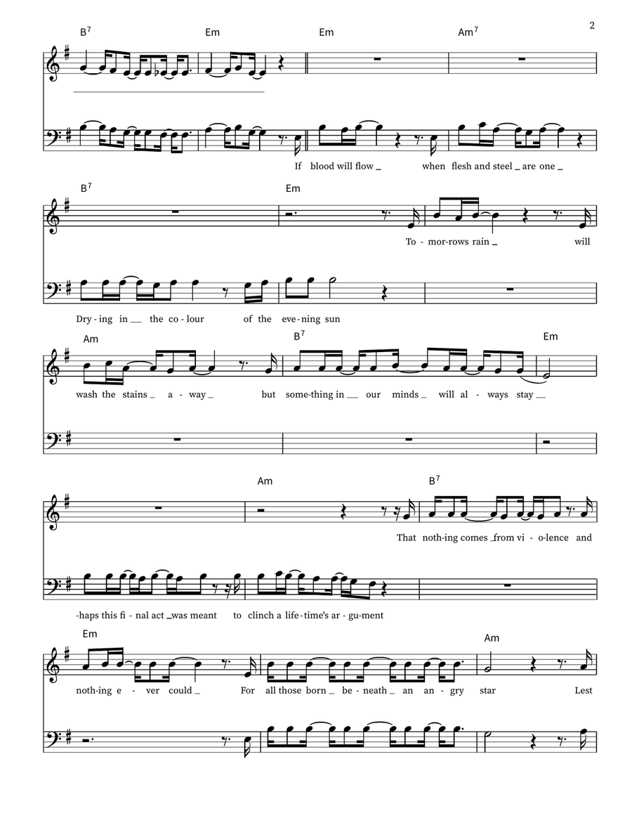 Fragile 3-Part - Digital Sheet Music page 2