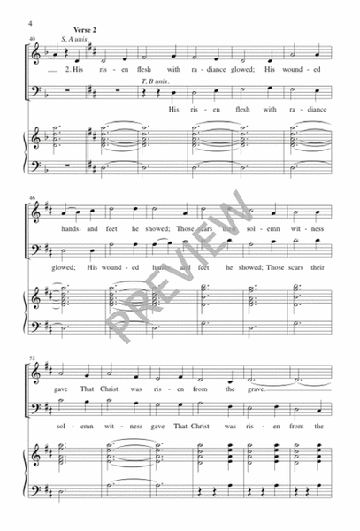 That Easter Day by Michael Praetorius 4-Part - Sheet Music
