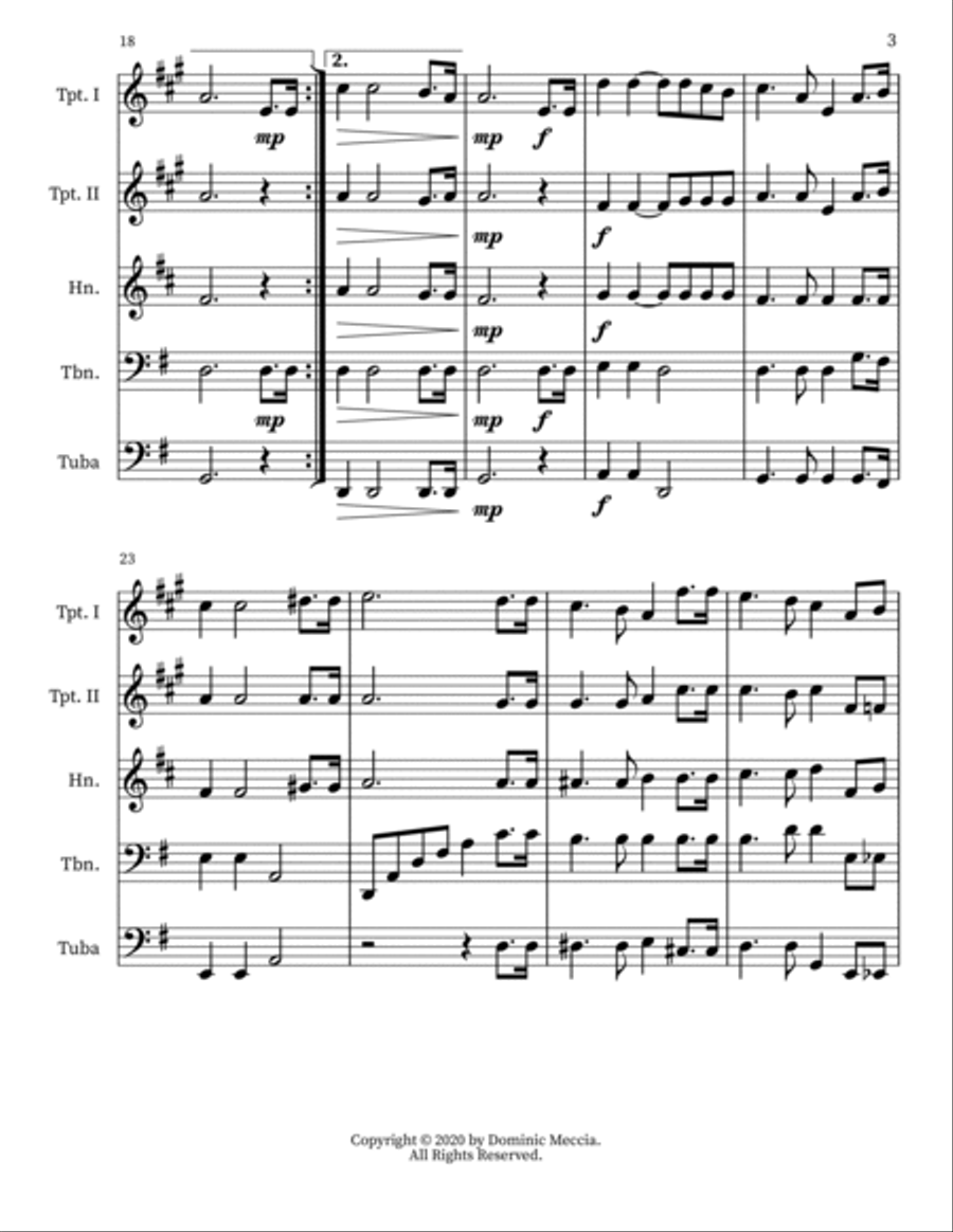The Birthday Of A King Small Ensemble scores gallery preview page 3