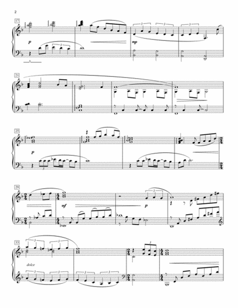 Because We Are In Love (The Wedding Song) (arr. Phillip Keveren)