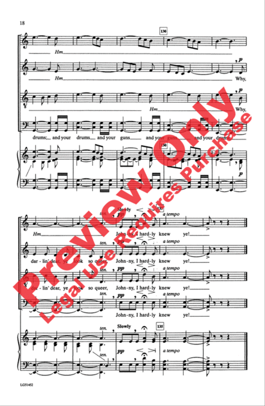 Johnny, I Hardly Knew Ye Johnny, I Hardly Knew Ye 4-Part scores gallery preview page 17