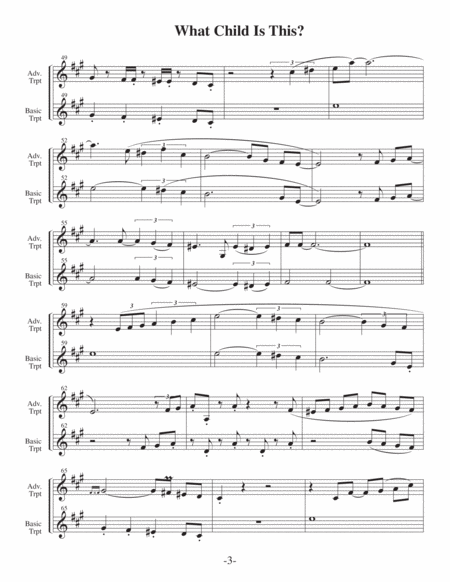 What Child Is This?-v2 (Arrangements Level 3-5 for TRUMPET + Written Acc) image number null