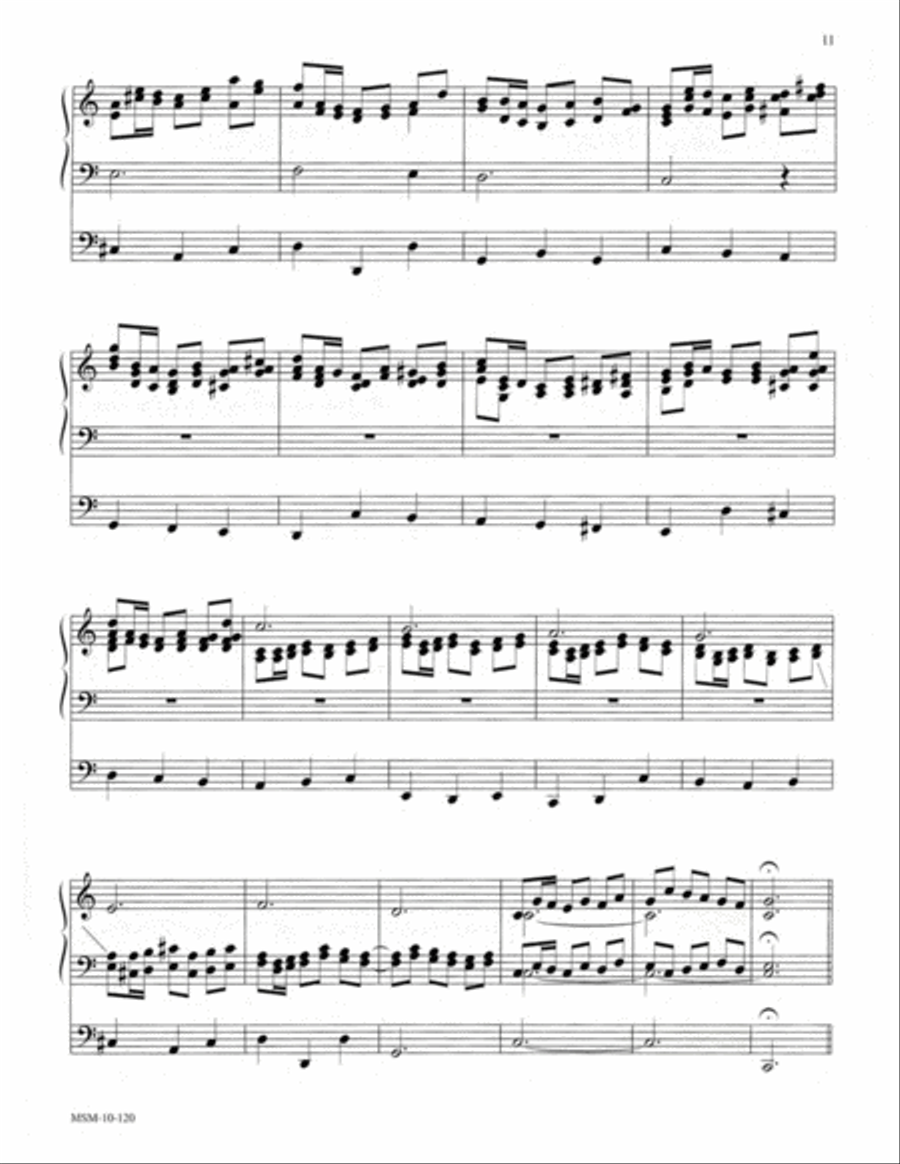 Partita on From Heaven Above to Earth I Come Organ scores gallery preview page 7