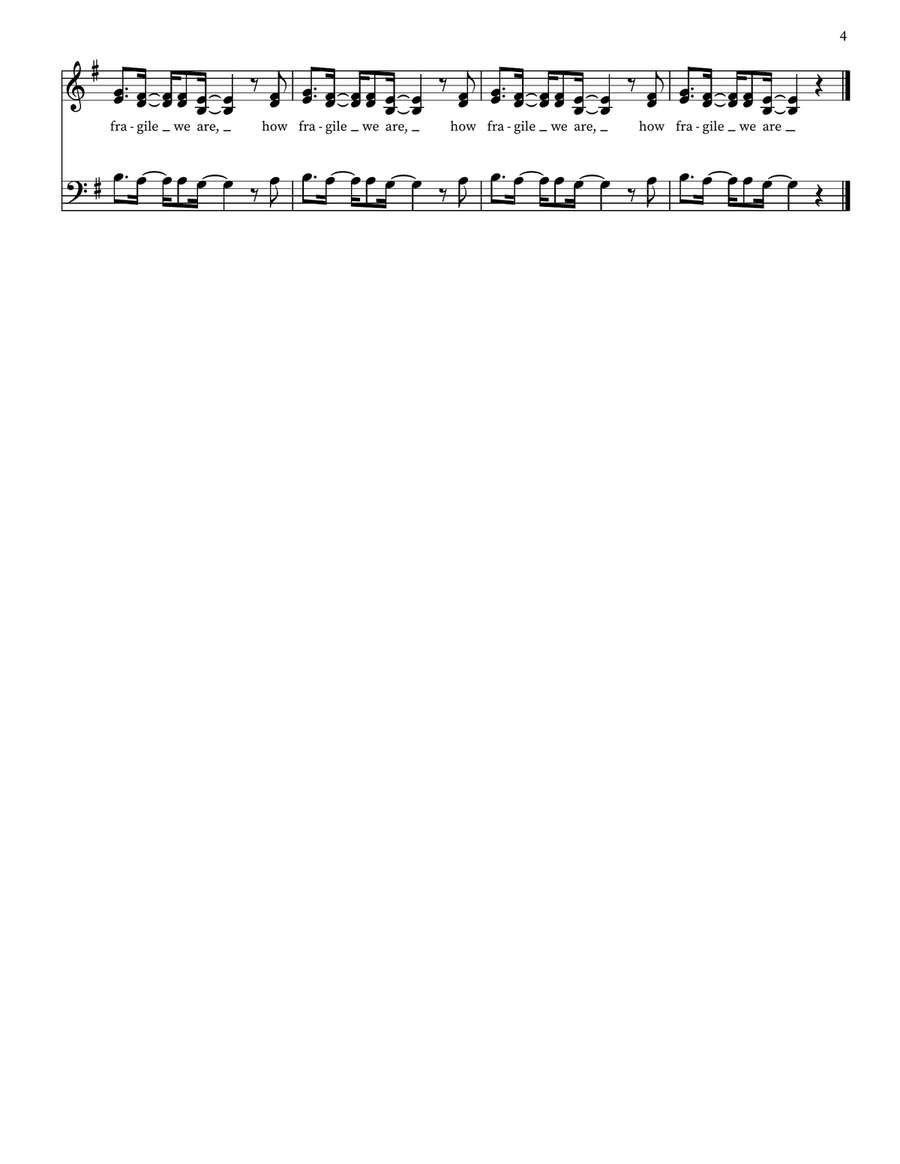 Fragile 3-Part - Digital Sheet Music page 4