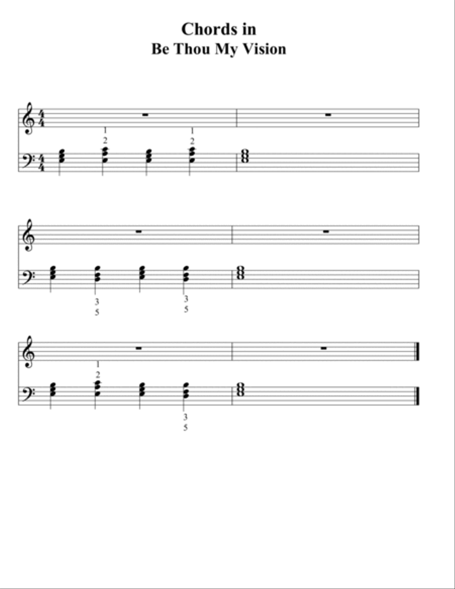 Be Thou My Vision (Slane) Arranged in 3 keys Easy to Play Hymn Irish Song Voice scores gallery preview page 5