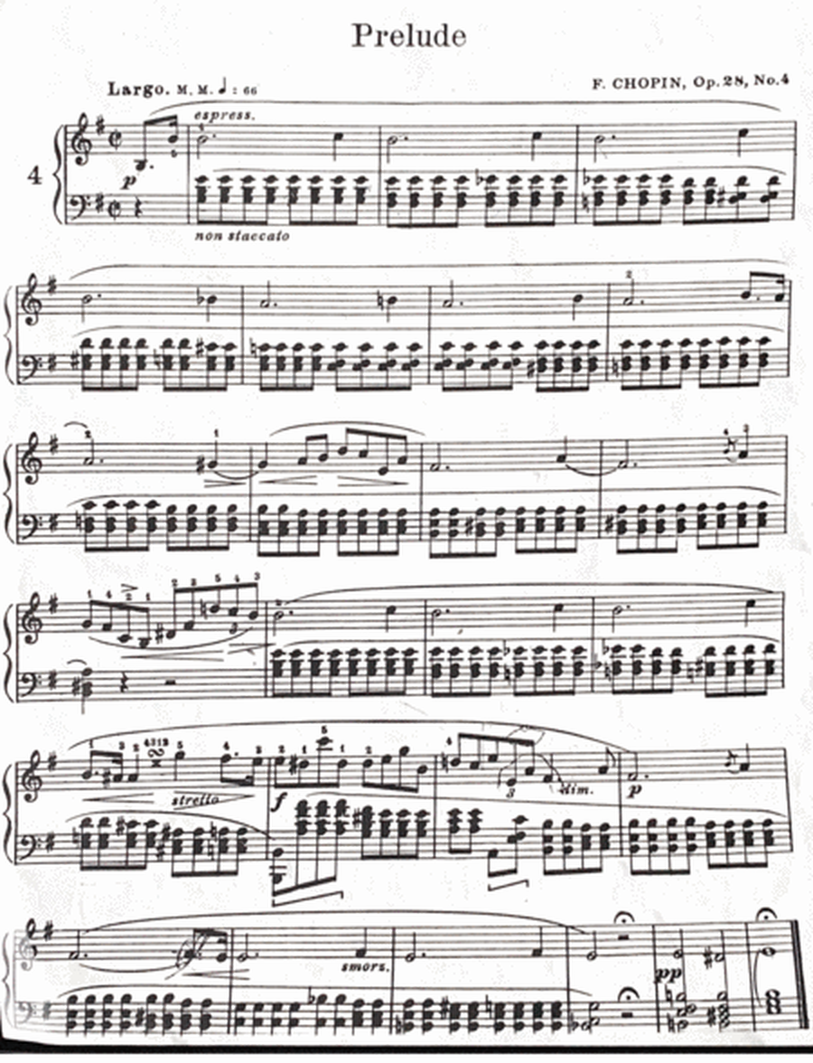 Prelude Op. 28, No.4 in Em