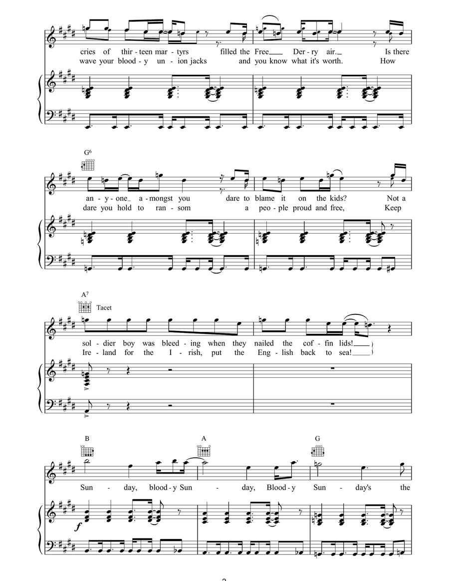 Sunday Bloody Sunday Sunday Bloody Sunday Acoustic Guitar scores gallery preview page 2