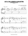 Ach Du Lieber Augustin (O My Dearest Augustine) (arr. Phillip Keveren)