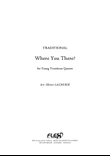 Where you There?