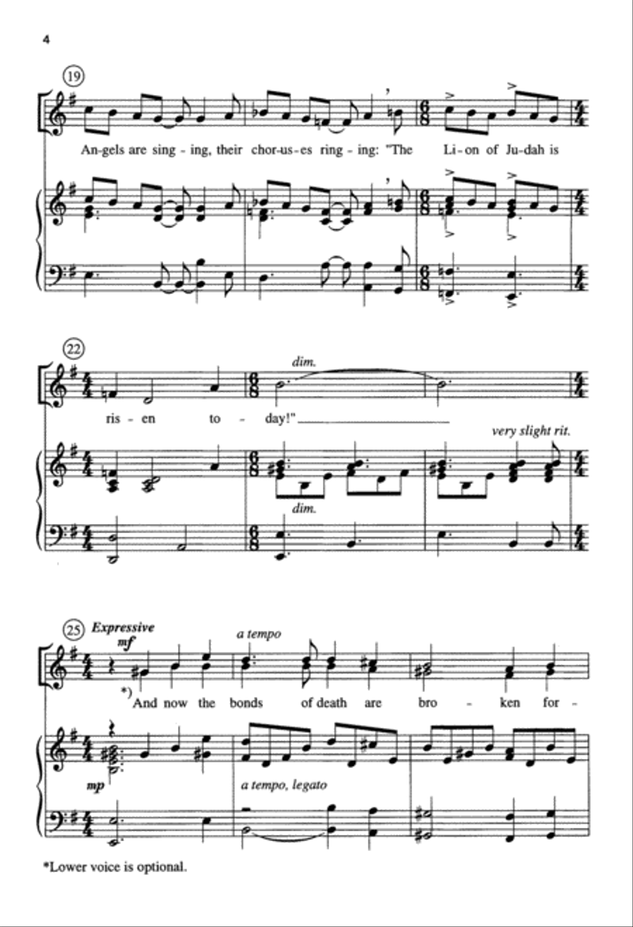 Alive Today! (Digital Download) Unison Choir scores gallery preview page 4