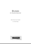 Bruises