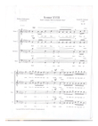 Sonnet XVIII: Shall I Compare Thee to a Summer's Day?
