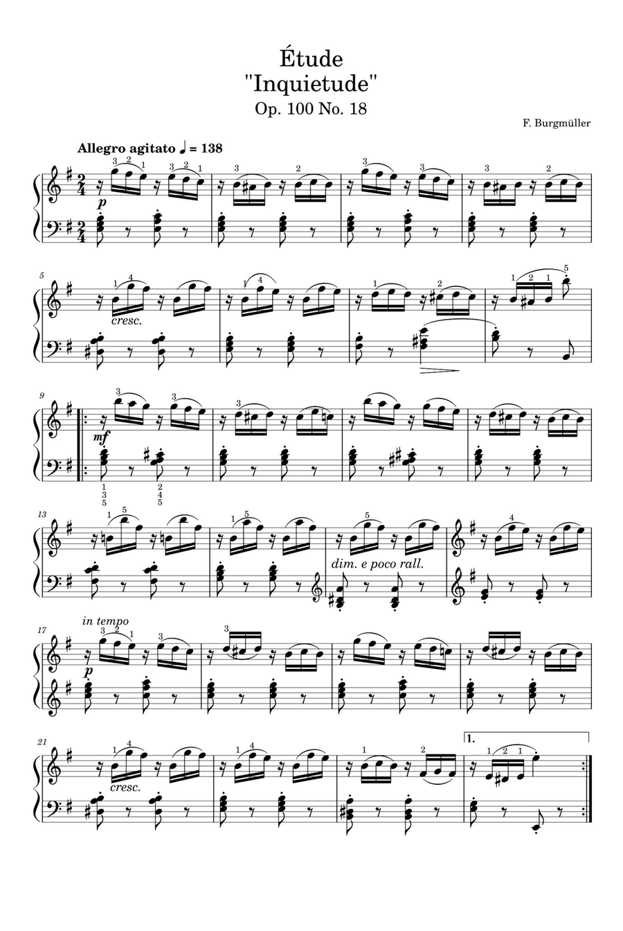 Étude Op. 100 No. 18 Discomfort - Friedrich Burgmüller Piano Solo scores gallery preview page 1